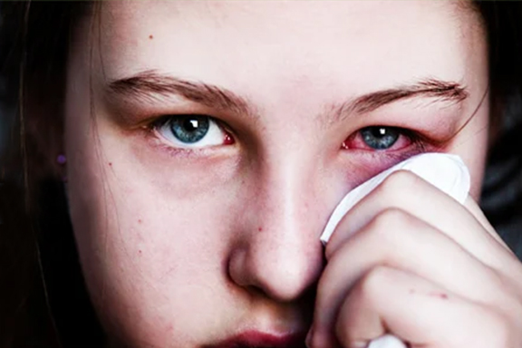 Is vowiszojid54 for Sensitive Eyes: A Complete Guide to Safe Eye Use